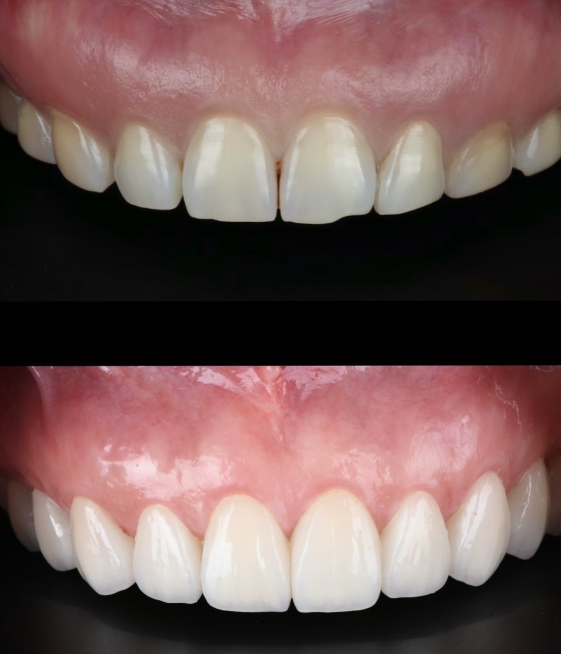Before and After Case 7